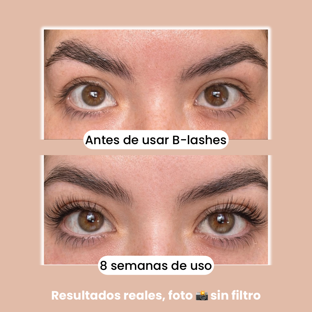 B-Lashes Suero Crecimiento Pestañas y Cejas.
