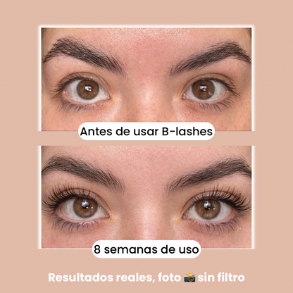 B-Lashes Suero Crecimiento Pestañas y Cejas.