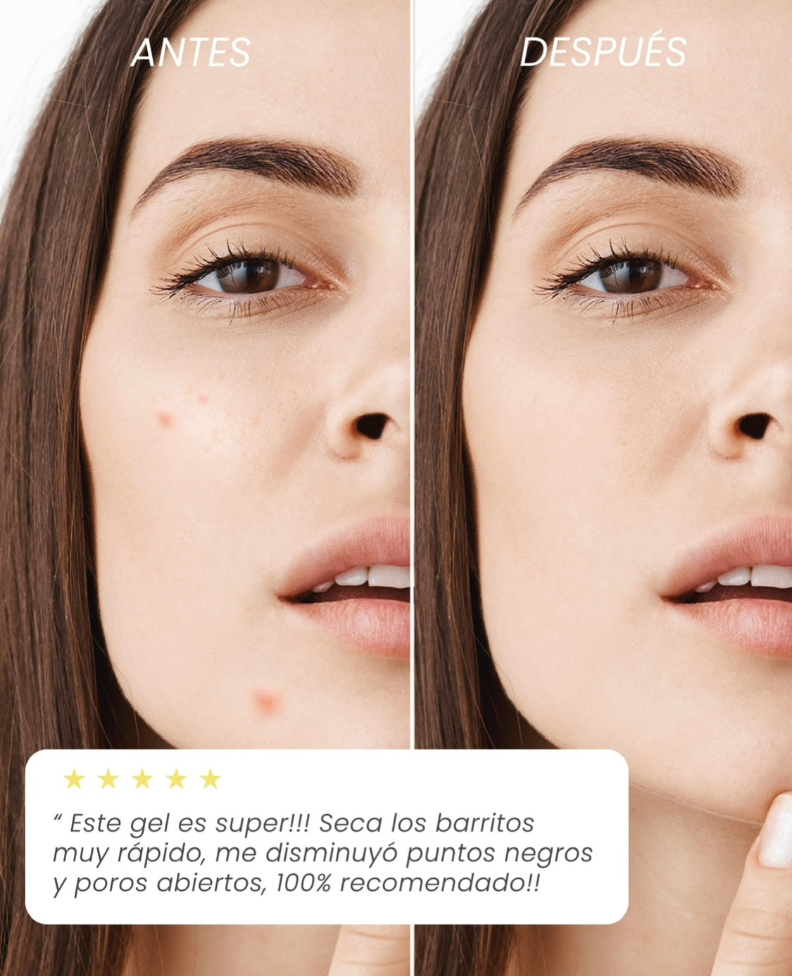 Gel Amarillo 30 g. Adiós Barritos.