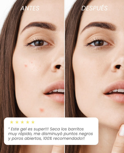 Gel Amarillo 30 g. Adiós Barritos.