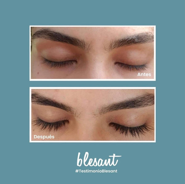B-Lashes suero crecimiento pestañas y cejas.